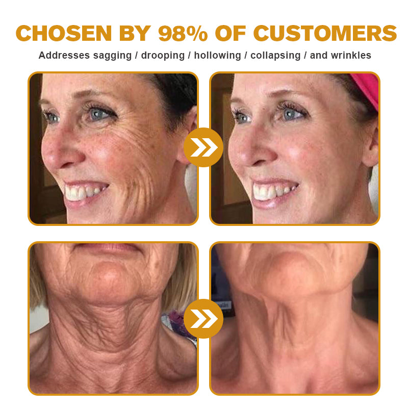 🔥 Experience Ultimate Luxury - 50% OFF - ✨ Champagne Beaute Lift Firming Body Crème - For Firmer, Smoother, Radiant Skin! 🌟(Buy 3 & Free Shipping)