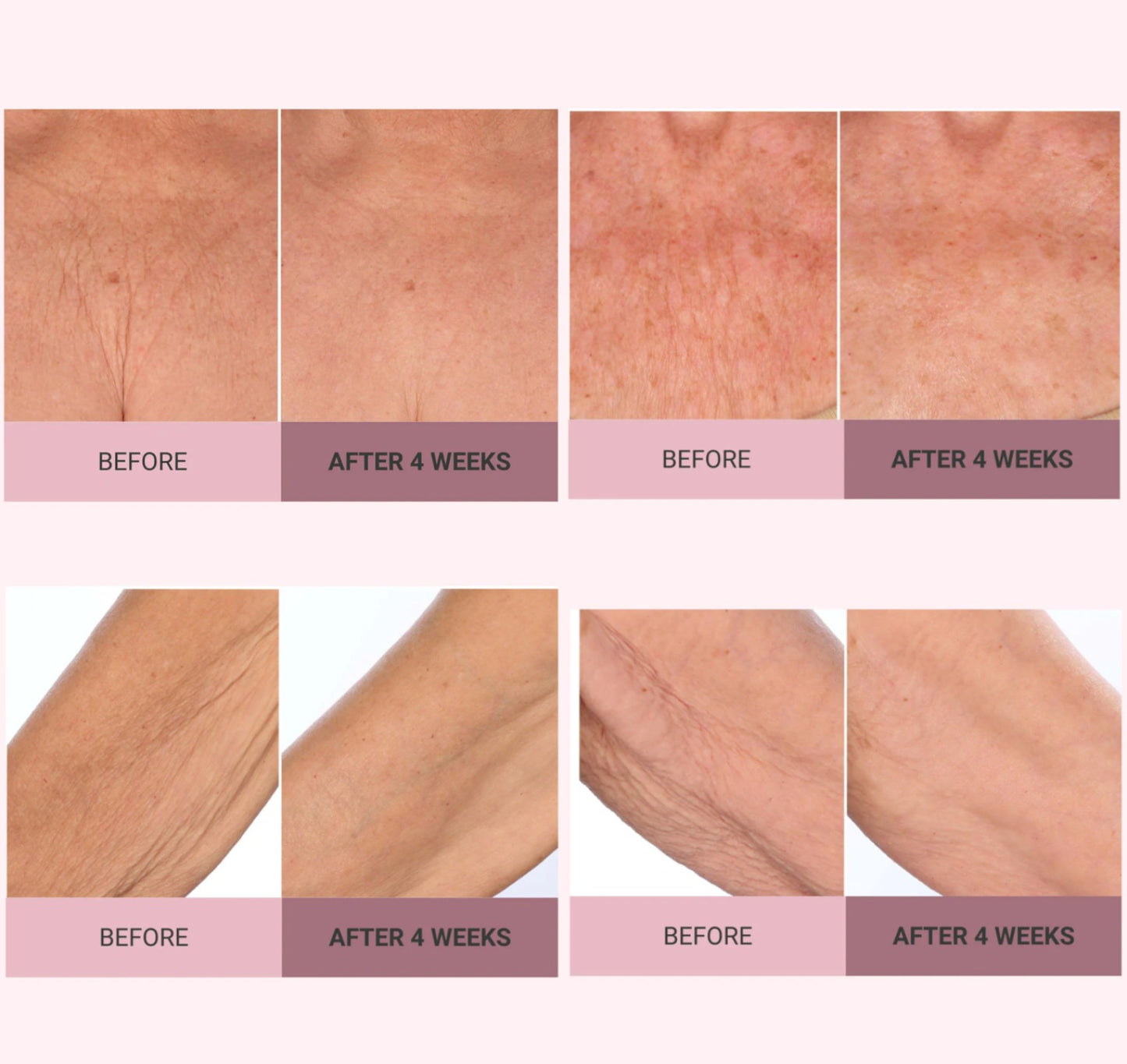 🎊 Experience Ultimate Luxury - 50% OFF - ✨ Champagne Beaute Lift Firming Body Crème - For Firmer, Smoother, Radiant Skin! 🌟(Buy 3 & Free Shipping)