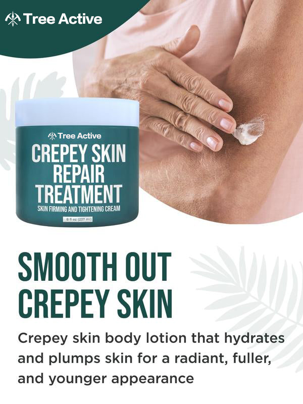 TreeActive Crepey Skin Repair Treatment, 8oz, Firming Cream with Hyaluronic Acid & Shea Butter to Deeply Moisturize & Tighten Wrinkly Dry Crepe Skin, 500+ Uses