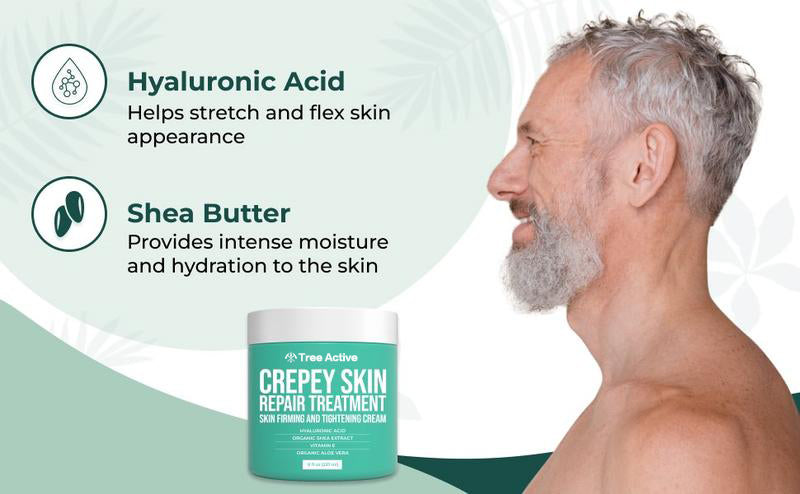 TreeActive Crepey Skin Repair Treatment, 8oz, Firming Cream with Hyaluronic Acid & Shea Butter to Deeply Moisturize & Tighten Wrinkly Dry Crepe Skin, 500+ Uses
