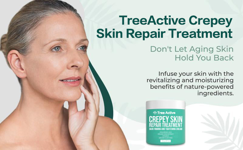 TreeActive Crepey Skin Repair Treatment, 8oz, Firming Cream with Hyaluronic Acid & Shea Butter to Deeply Moisturize & Tighten Wrinkly Dry Crepe Skin, 500+ Uses