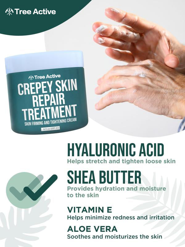 TreeActive Crepey Skin Repair Treatment, 8oz, Firming Cream with Hyaluronic Acid & Shea Butter to Deeply Moisturize & Tighten Wrinkly Dry Crepe Skin, 500+ Uses