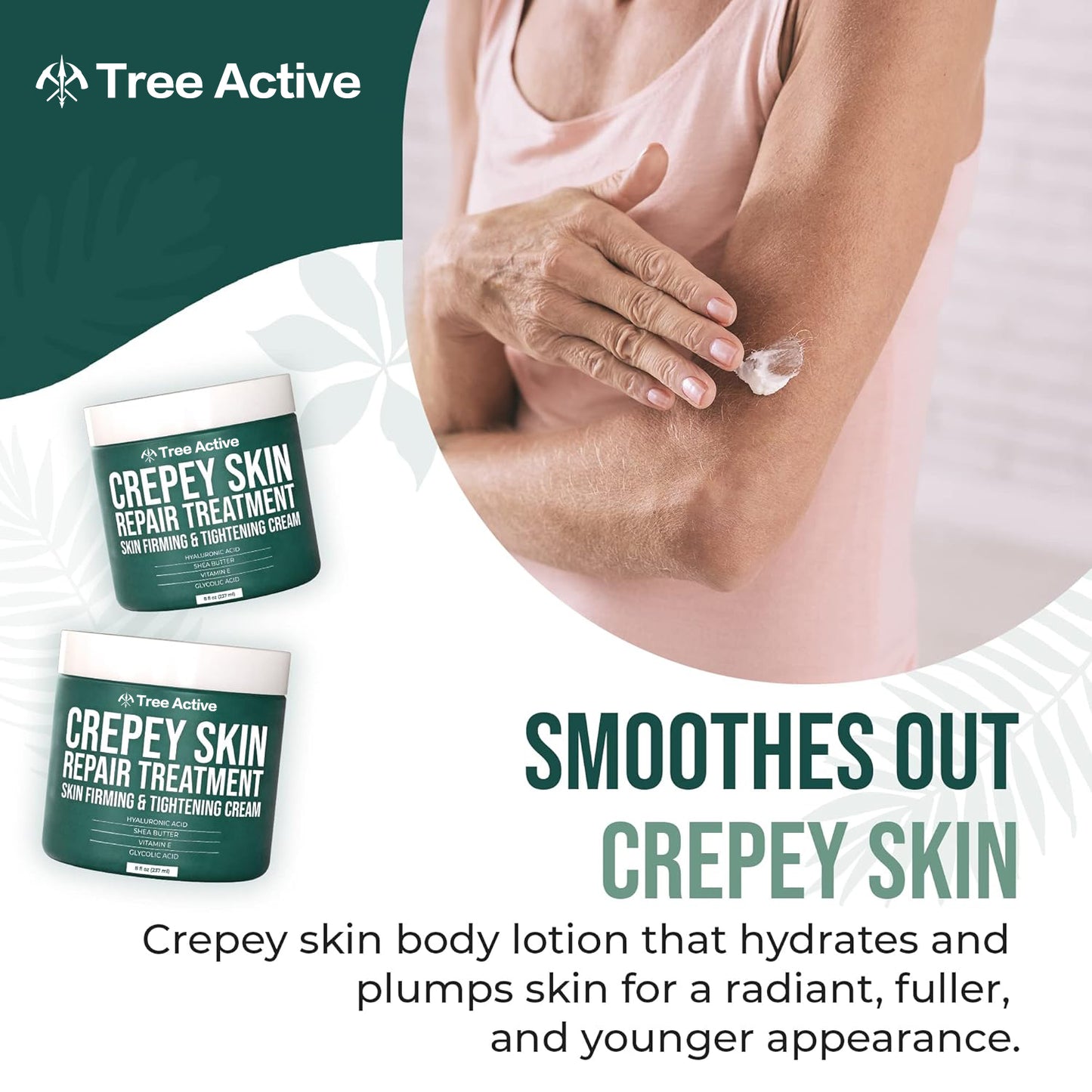 TreeActive Crepey Skin Repair Treatment, 8oz, Firming Cream with Hyaluronic Acid & Shea Butter to Deeply Moisturize & Tighten Wrinkly Dry Crepe Skin, 500+ Uses