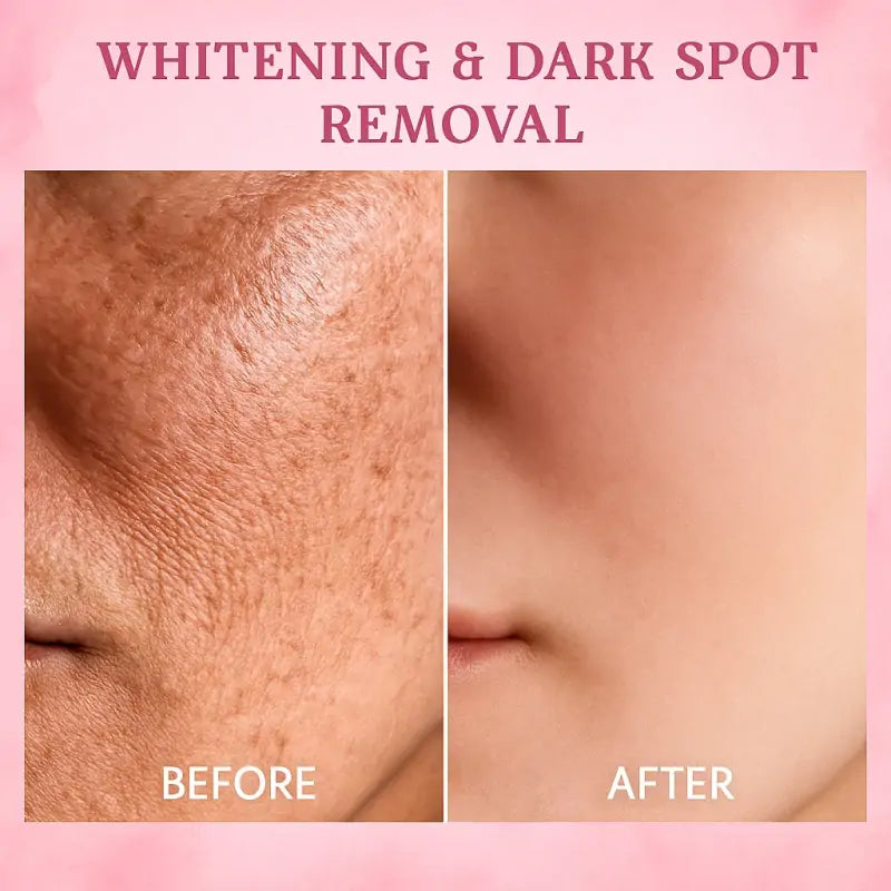 ๐ฅ๐๐๐ฌ๐ญ ๐๐๐ฒ ๐๐ข๐ฌ๐๐จ๐ฎ๐ง๐ญ: ๐5% ๐๐
๐
- CONSULI BEAUTEยฎ 7-Day Body Reset: The All-in-One Firming & Brightening Cream