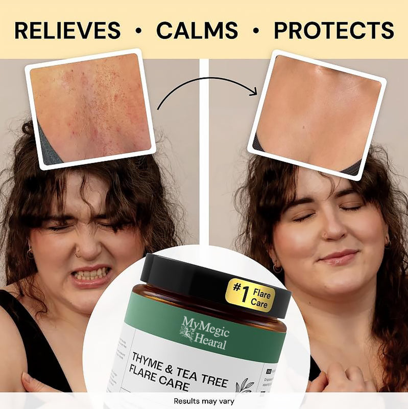 MyMegicHearal's Thyme & Tea Tree Flare Care | Cystic Acne and Bumps Treatment Skincare Daily Pimple