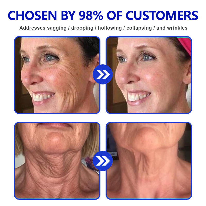 Made and Shipped fromUK✨A3113 Vitamin A Pommade + Ialusef Hyaluronic Acid Anti-Wrinkle Cream(🔥LAST DAY 70% OFF)💄