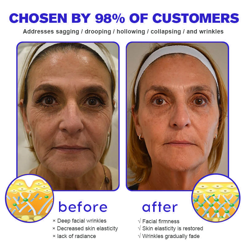 Made and Shipped fromUK✨A3113 Vitamin A Pommade + Ialusef Hyaluronic Acid Anti-Wrinkle Cream(🔥LAST DAY 70% OFF)💄