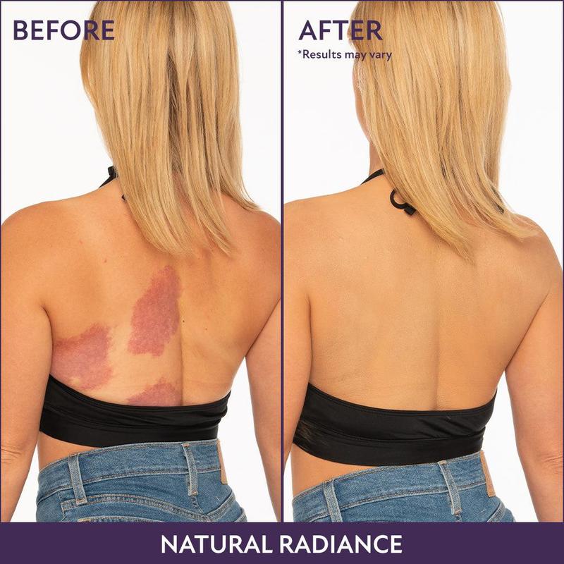 ESSENTIN Glow Body Coverage Perfector - Waterproof Leg & Body Makeup - Tattoo Coverage Makeup - 3.5 oz (free makeup brush)