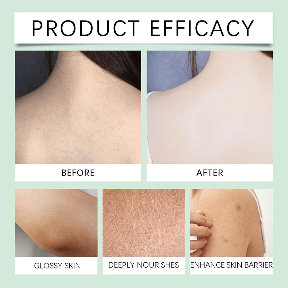 🎊 Experience Ultimate Luxury - 50% OFF - ✨ Champagne Beaute Lift Firming Body Crème - For Firmer, Smoother, Radiant Skin! 🌟(Buy 3 & Free Shipping)
