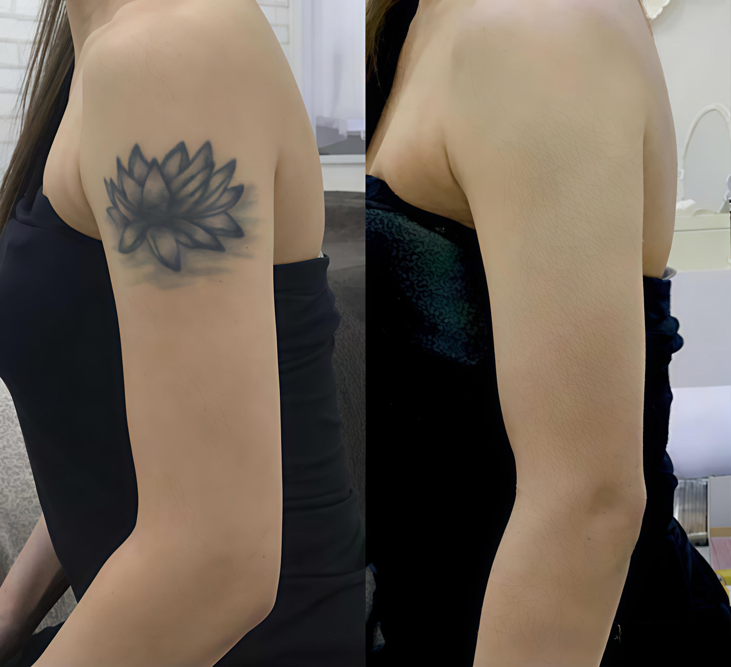 ESSENTIN Glow Body Coverage Perfector - Waterproof Leg & Body Makeup - Tattoo Coverage Makeup - 3.5 oz (free makeup brush)
