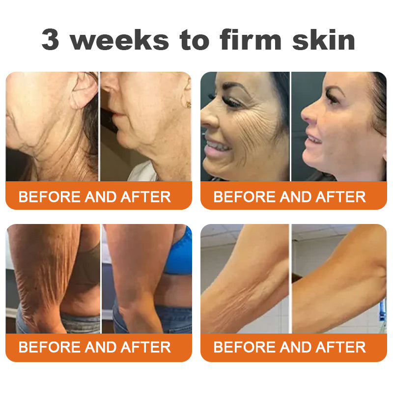 🔥 Experience Ultimate Luxury - 50% OFF - ✨ Champagne Beaute Lift Firming Body Crème - For Firmer, Smoother, Radiant Skin! 🌟(Buy 3 & Free Shipping)