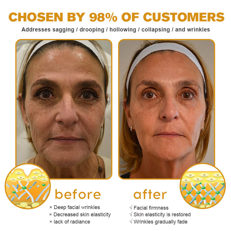 (Made and Shipped from UK) 🧑⚕️Anti-Wrinkle Toning Polish Pads - LAST DAY 70% OFF🔥