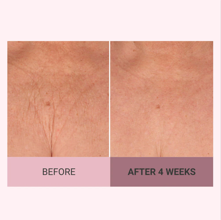 💆♀️ Experience Ultimate Luxury - 50% OFF - ✨ Champagne Beaute Lift Firming Body Crème - For Firmer, Smoother, Radiant Skin! 🌟(Buy 3 & Free Shipping)