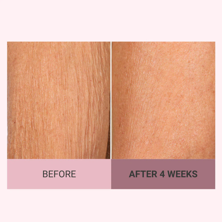 💆♀️ Experience Ultimate Luxury - 50% OFF - ✨ Champagne Beaute Lift Firming Body Crème - For Firmer, Smoother, Radiant Skin! 🌟(Buy 3 & Free Shipping)