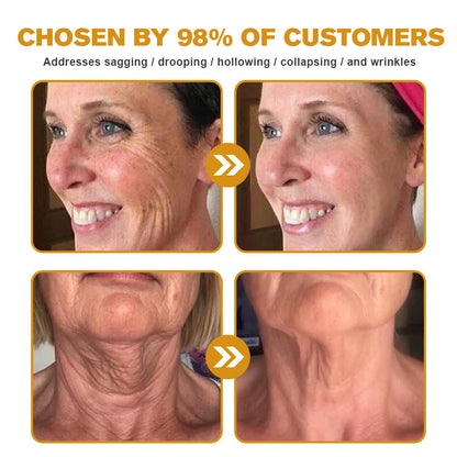 🔥 Experience Ultimate Luxury - 50% OFF - ✨ Champagne Beaute Lift Firming Body Crème - For Firmer, Smoother, Radiant Skin! 🌟（Buy 3 & Free Shipping）