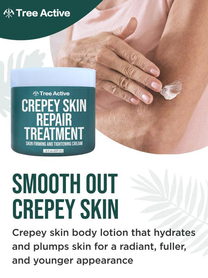 TreeActive Crepey Skin Repair Treatment, 8oz, Firming Cream with Hyaluronic Acid & Shea Butter to Deeply Moisturize & Tighten Wrinkly Dry Crepe Skin, 500+ Uses