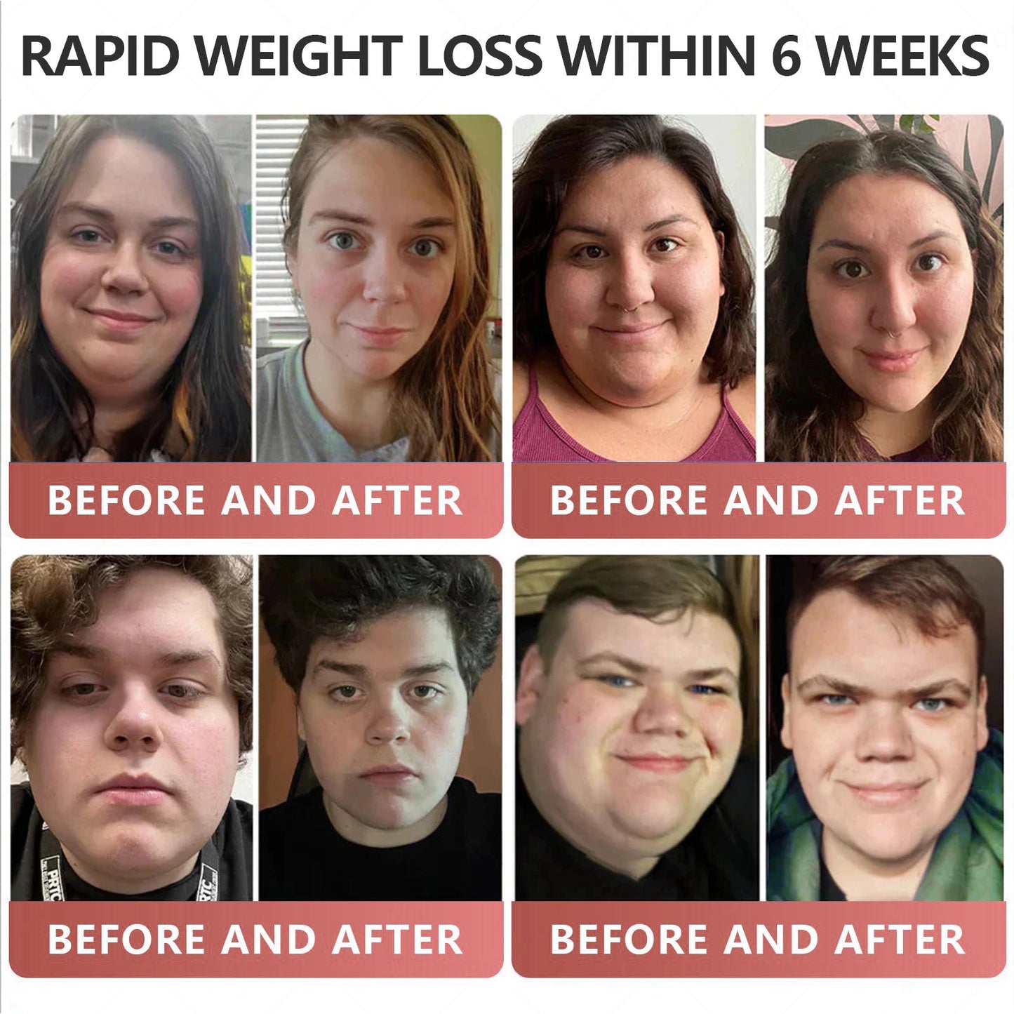 GLP-1 Patches🎉 - Slimming, Skin Tightening, Blood Sugar Support, No Injection, 7- Day Result