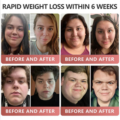 GLP-1 Patches🎉 - Slimming, Skin Tightening, Blood Sugar Support, No Injection, 7- Day Result