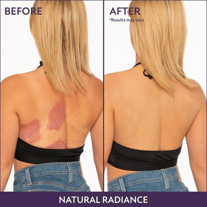 ESSENTIN Glow Body Coverage Perfector - Waterproof Leg & Body Makeup - Tattoo Coverage Makeup - 3.5 oz (free makeup brush)