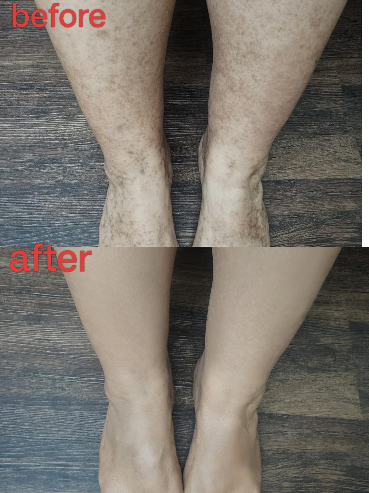 ESSENTIN Glow Body Coverage Perfector - Waterproof Leg & Body Makeup - Tattoo Coverage Makeup - 3.5 oz (free makeup brush)