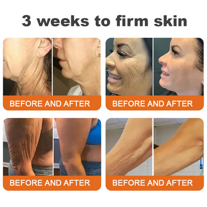 🔥 Experience Ultimate Luxury - 50% OFF - ✨ Champagne Beaute Lift Firming Body Crème - For Firmer, Smoother, Radiant Skin! 🌟（Buy 3 & Free Shipping）
