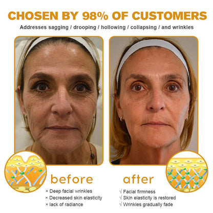 (Made and Shipped from UK) 🧑‍⚕️Anti-Wrinkle Toning Polish Pads - LAST DAY 70% OFF🔥