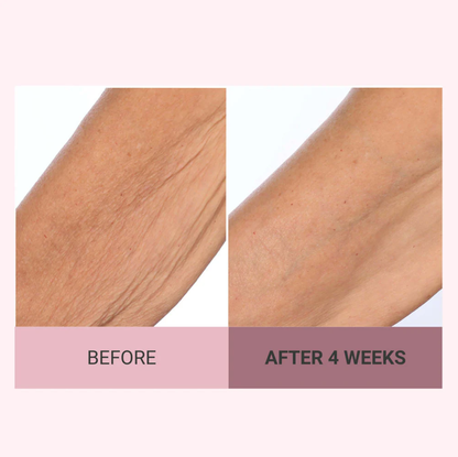 💆‍♀️ Experience Ultimate Luxury - 50% OFF - ✨ Champagne Beaute Lift Firming Body Crème - For Firmer, Smoother, Radiant Skin! 🌟（Buy 3 & Free Shipping）